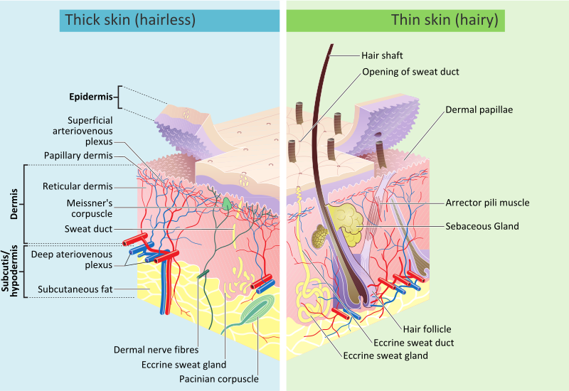 Medical diagram of skin layers and scar formation.