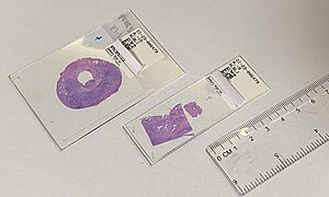 Microscopic slide of tissue sample